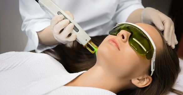 Procedimento de rejuvenescimento da pele a laser não ablativo